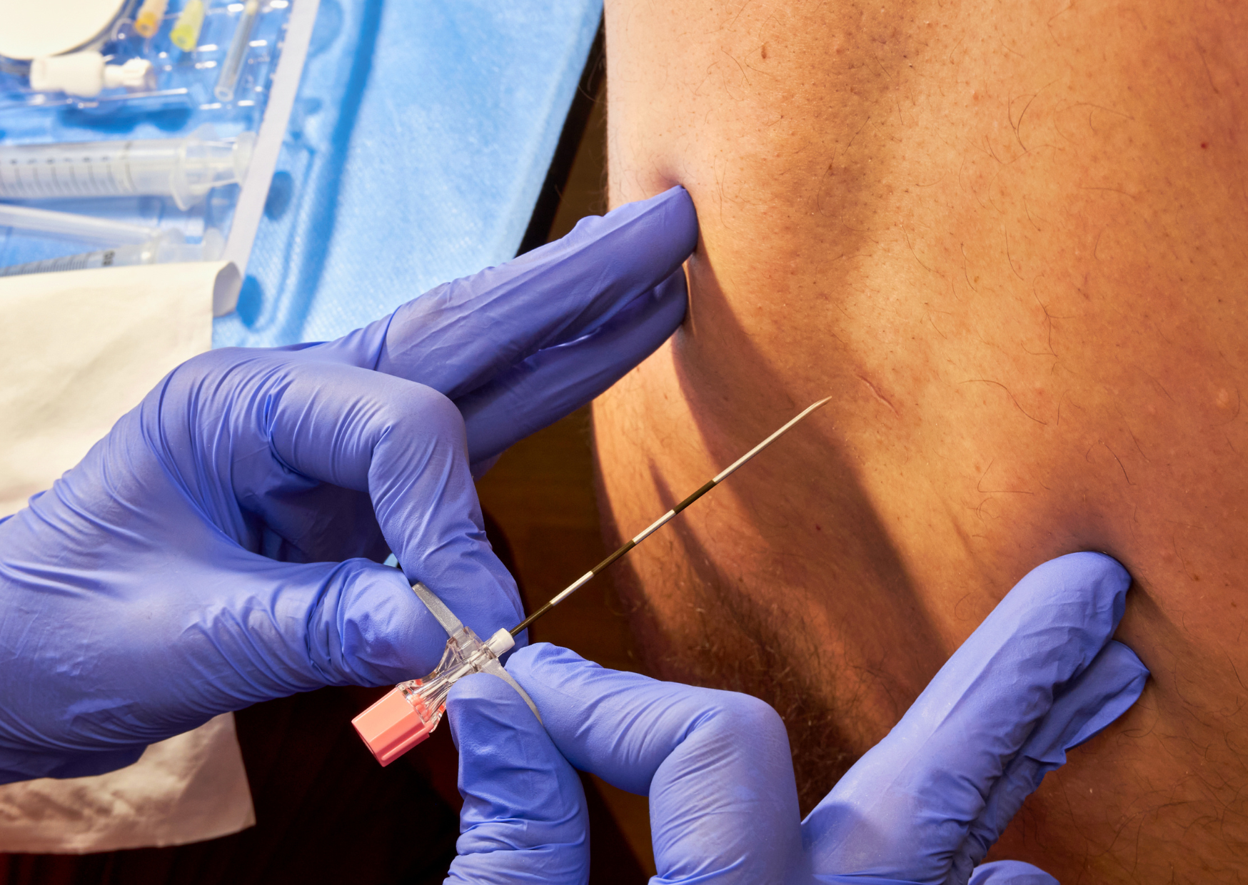 Medical Treatment Spanish People Refuse 4