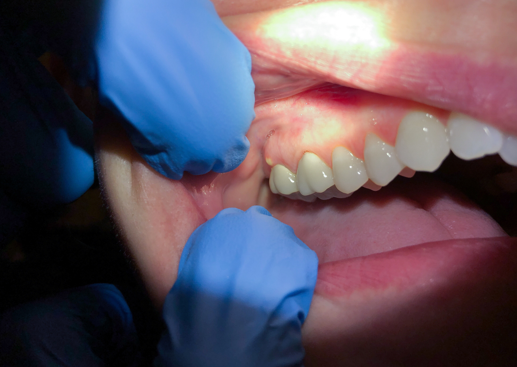 Dental Emergency in Europe 4