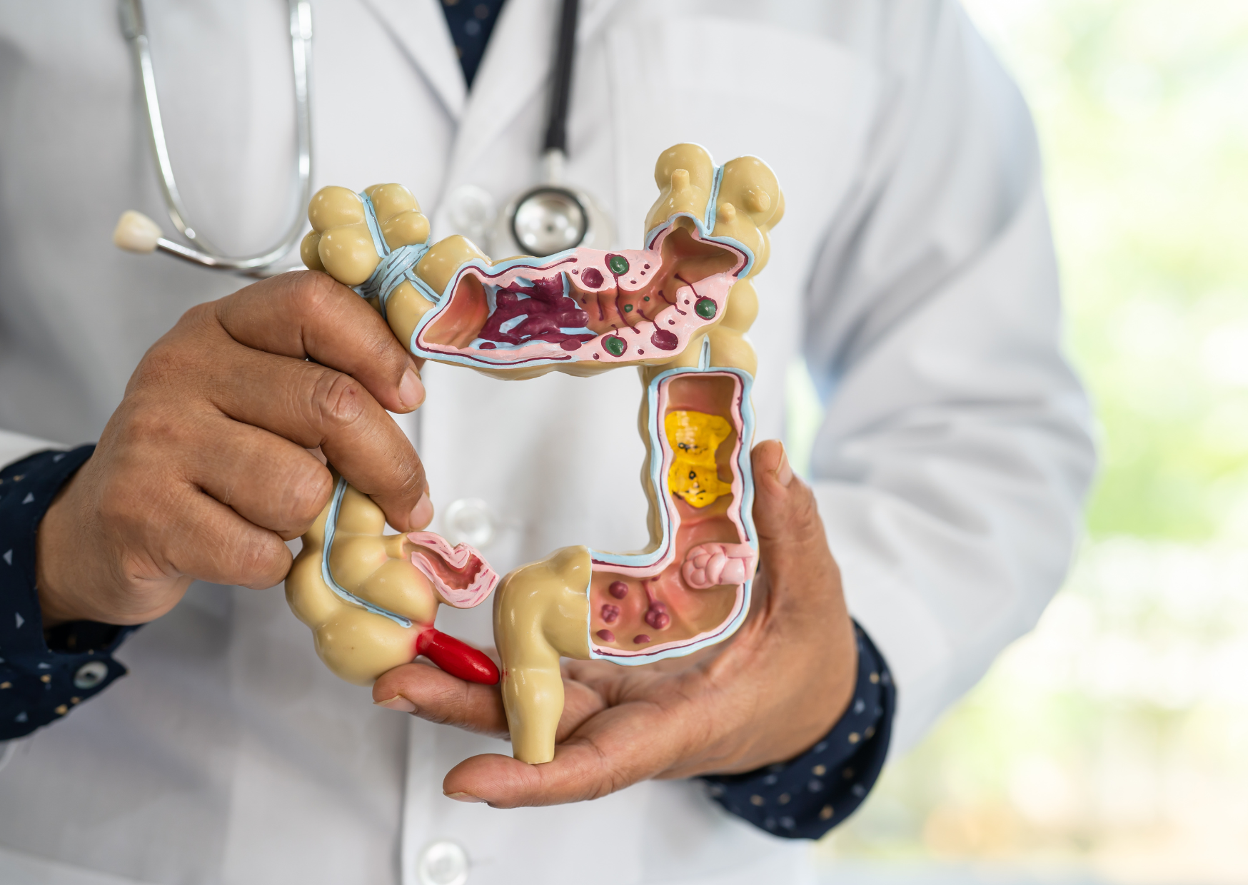 Europeans Examine Their Bowel 5