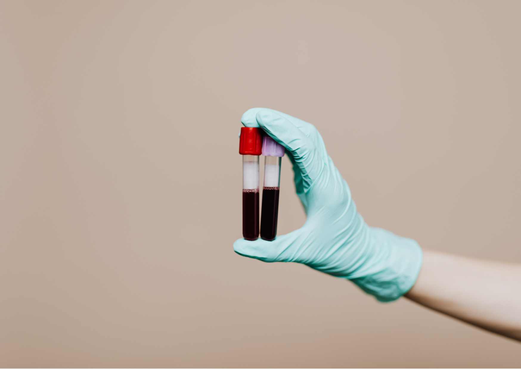 Annual blood tests 2