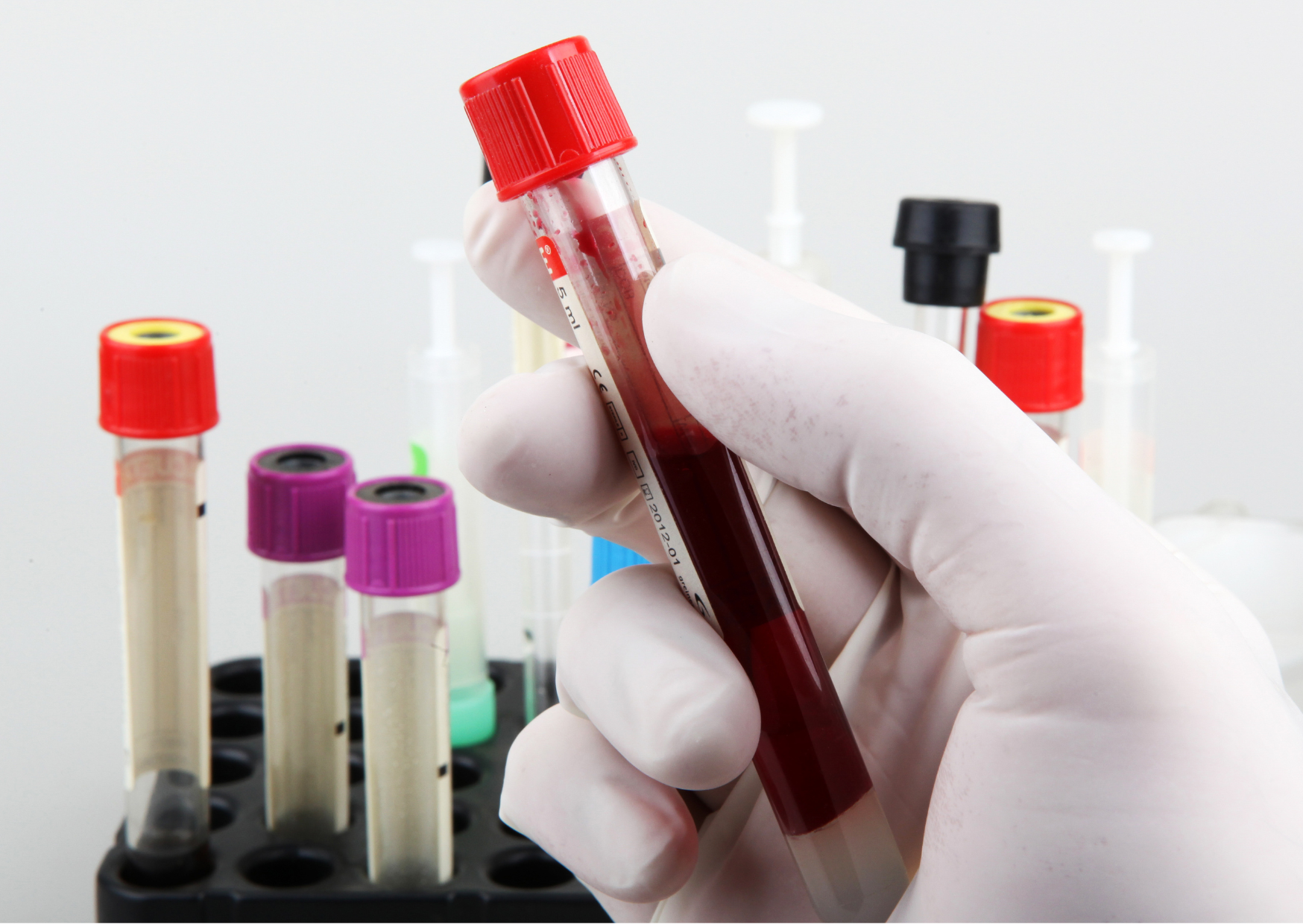 Annual blood tests 5