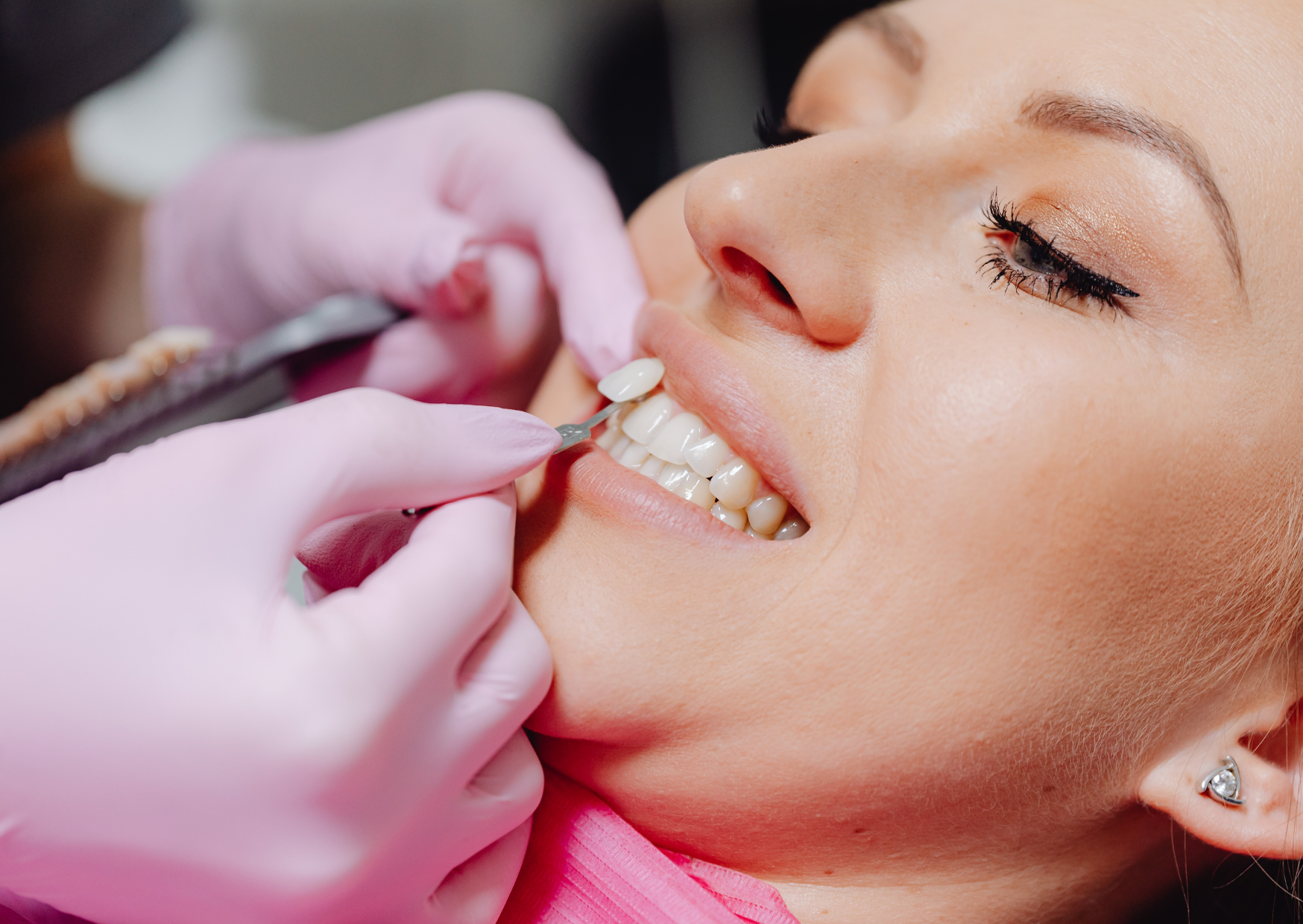 The British Teeth Americans Spend $50,000 to “Fix” That Work Fine 5 british teeth